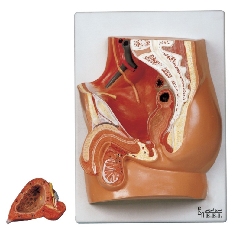 مدل لگن خاصره مرد - این مدل در اندازه طبیعی است و به دو قطعه تفکیک می‌شود. در این مدل ساختمان مثانه و اندام‌های تناسلی مرد در مقطع میانی و موقعیت آن‌ها در حفره لگن نمایش داده شده است. مدل روی تخته نصب شده است.در این مدل نحوه استقرار مثانه در حفره لگن، ارتباط میزنای با مثانه و عبور کانال دفران(اسپرم بر) از کشاله‌ران مشا ...